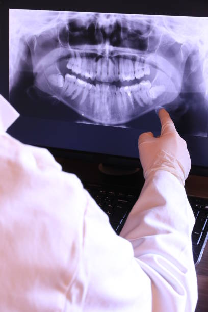 Best Knocked-Out Tooth (Avulsed Tooth) Treatment in Germantown Hls, IL