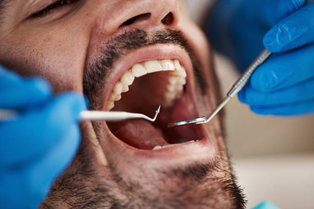 Best Weekend Emergency Dental Services in Germantown Hls, IL